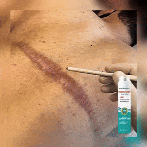 Spray Pielęgnacyjny Wygładzający Blizny