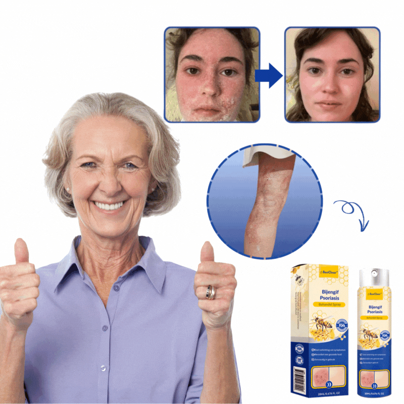 Spray do Pielęgnacji Skóry – Nawilżający, Kojący, Szybko Wchłanialny