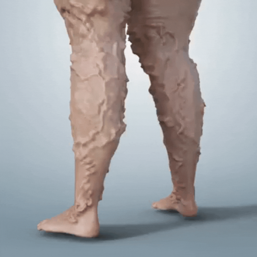 Intravénás egészségügyi javítás