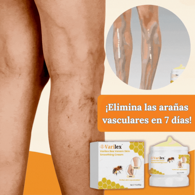 Maść żyły przeciwwarykozy